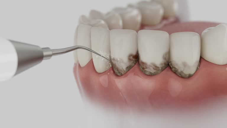 Reliable Teeth Cleaning And Checkup contractor in Hinds County County, MS by Dentist Open Now